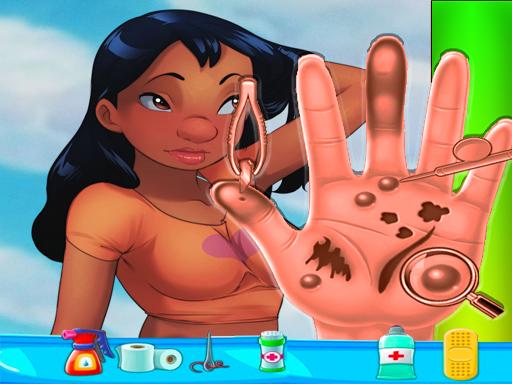 Play Nani Pelekai Hand Doctor Game