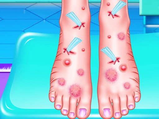 Play Emma Foot Treatment Game