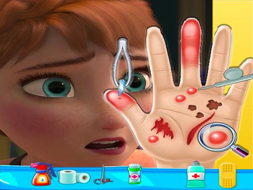 Play Anna Frozen Hand Doctor Game