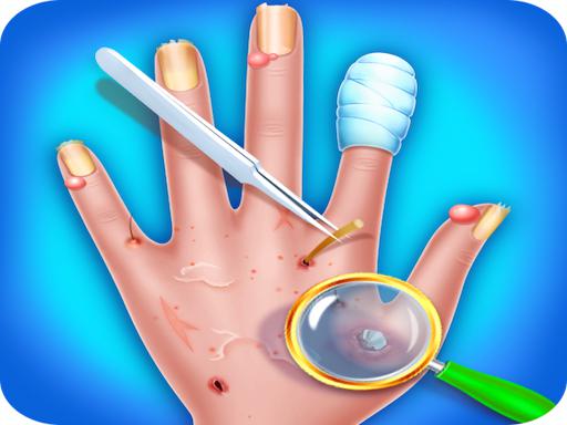 Play Hand Skin Doctor Game