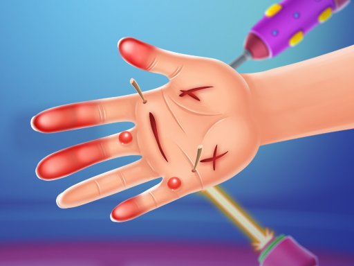 Play Hand Doctor Game