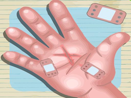 Play Hand Surgery Doctor Game